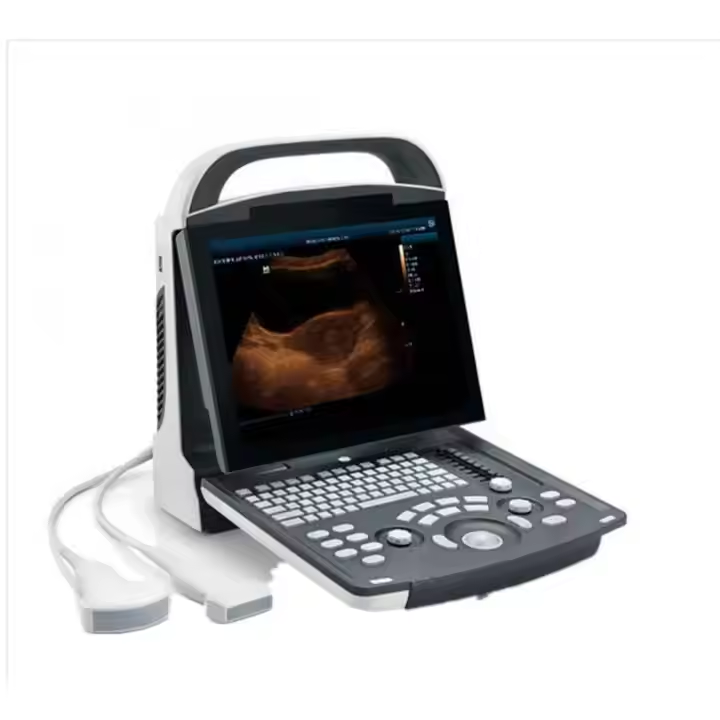 215-4D Color Ultrasound Technology Medical Instruments Electric Power Source Concise Clear Blood Flow Vi.jpg